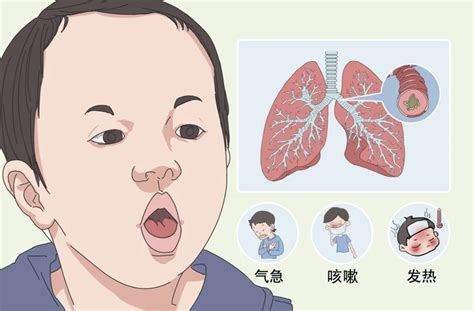 小孩一直咳嗽|孩子咳嗽老不好，终于找到原因了！这8件事家长一定要做